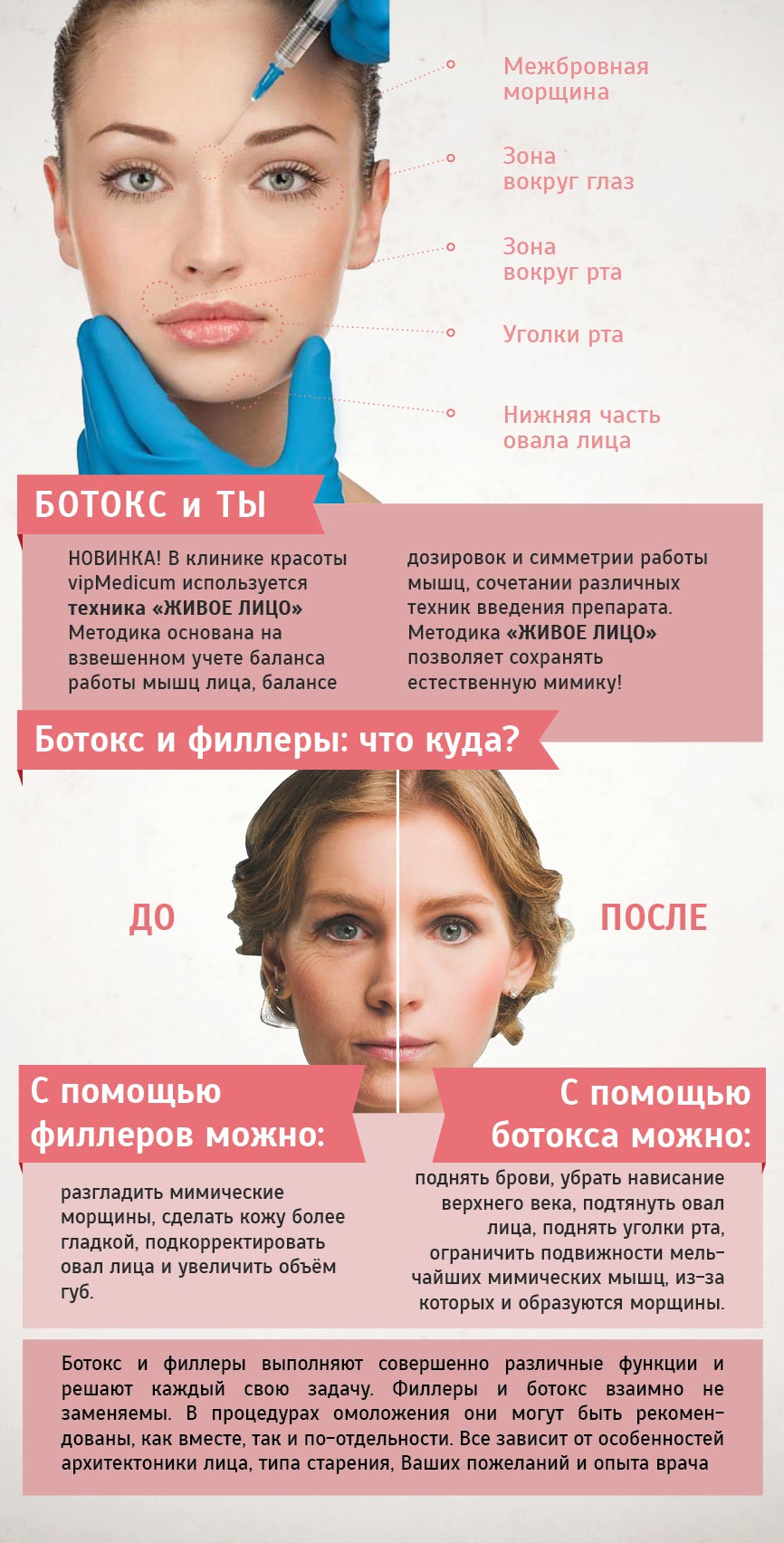 уколы ботокса - коррекция морщин в таллинне