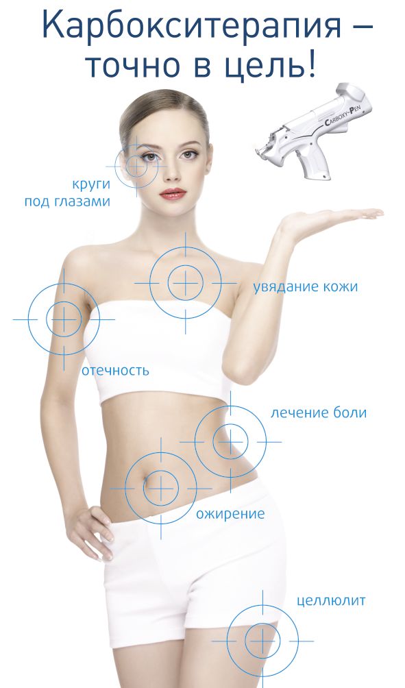 Карбокситерапия