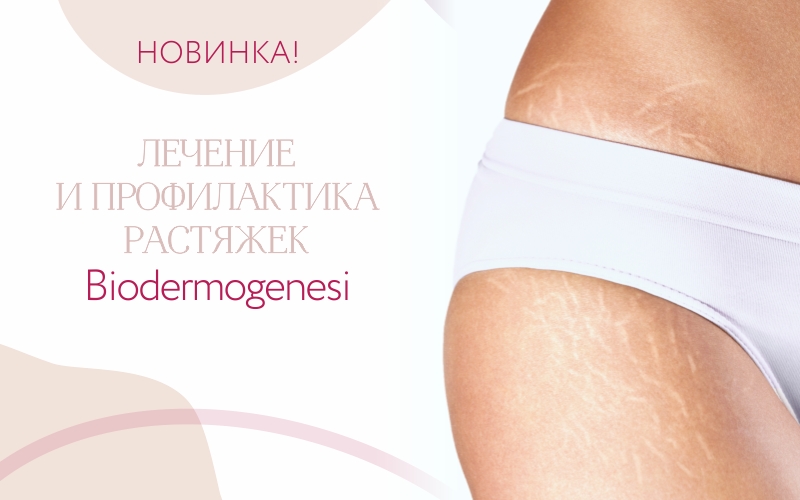 «НЕТ!» растяжкам и дряблости кожи