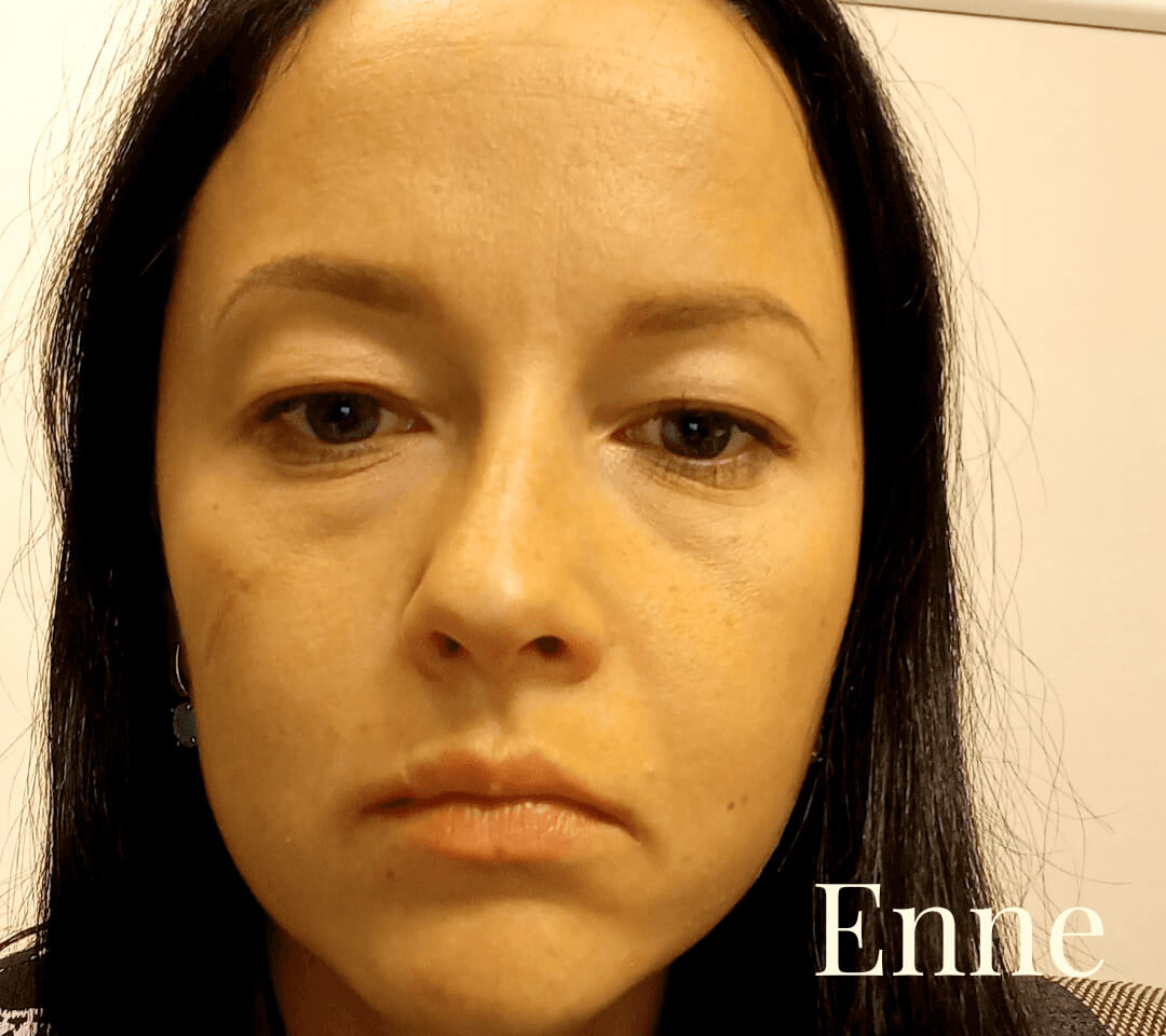enne