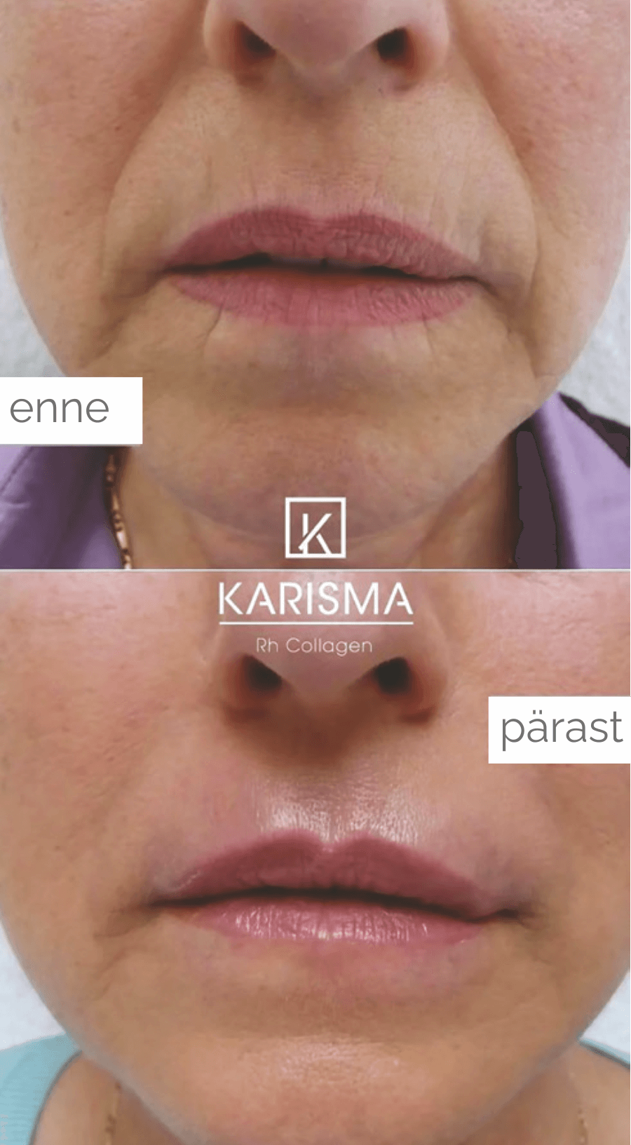 kariama_enne_parast2