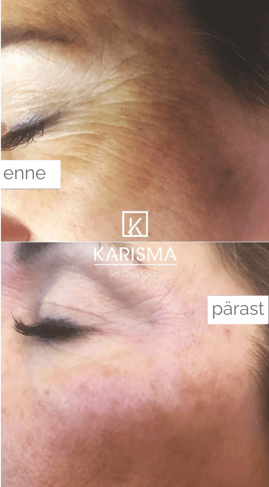 kariama_enne_parast3