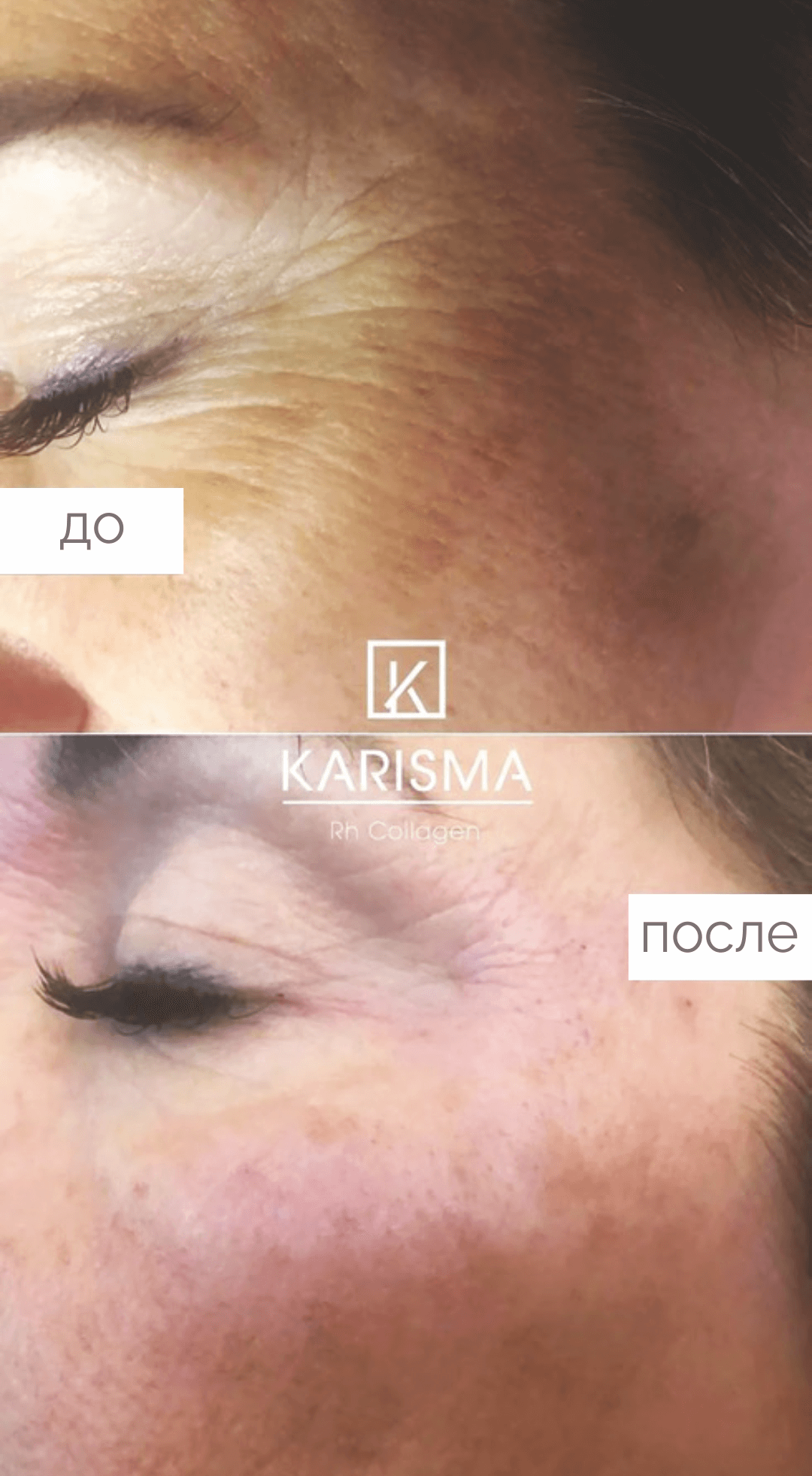 kariama_enne_parast3