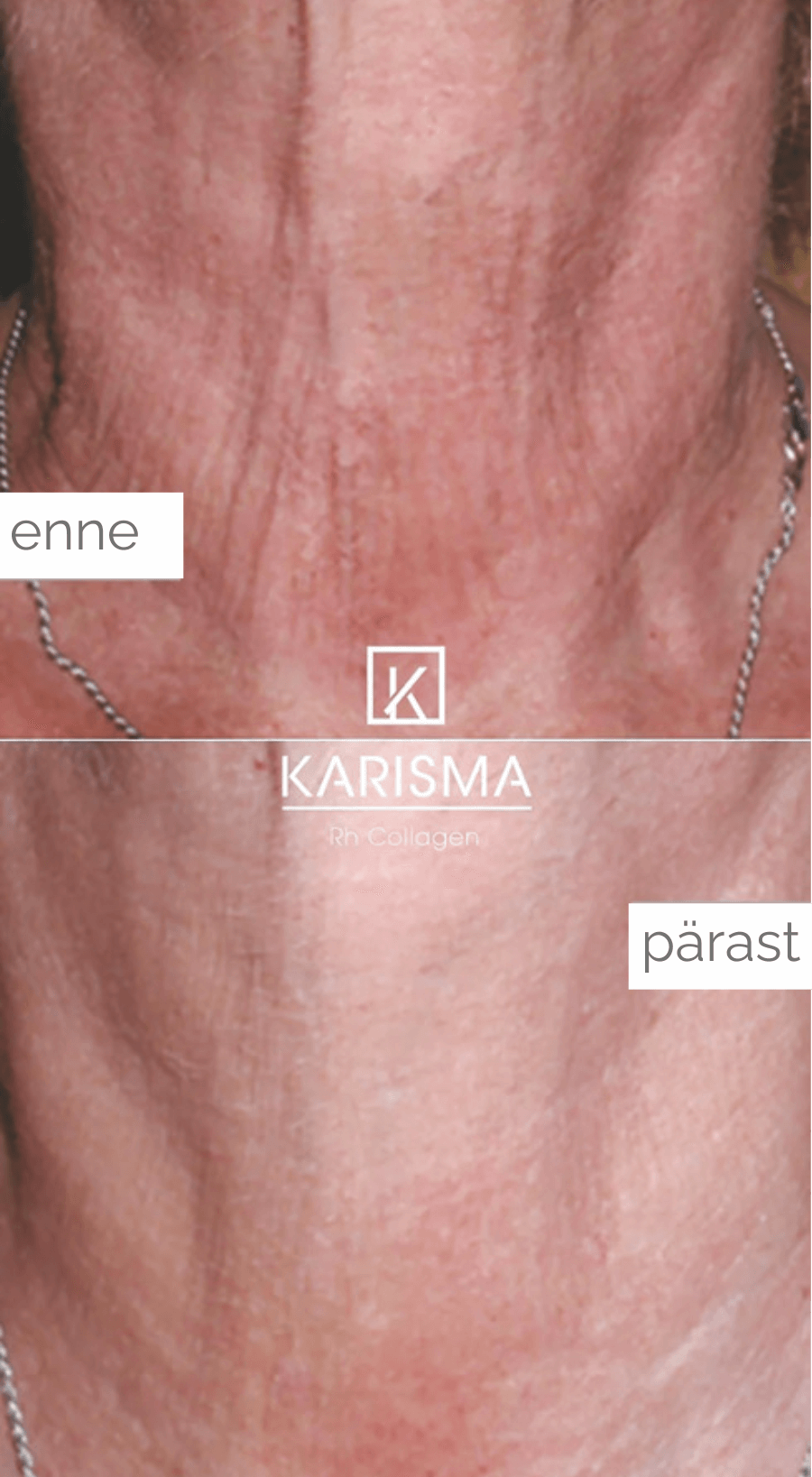 kariama_enne_parast4